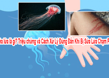 Sứa lửa là gì? Triệu chứng và Cách Xử Lý Đúng Đắn Khi Bị Sứa Lửa Chạm Phải